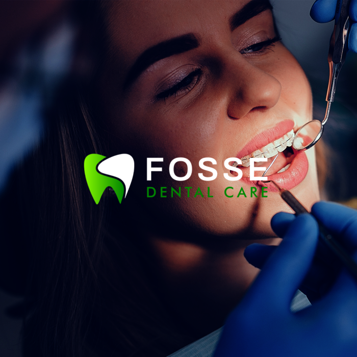 Fosse Mock 9-Square Fosse Mock 9-Square